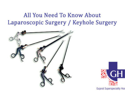 All You Need To Know About Laparoscopic Surgery / Keyhole Surgery