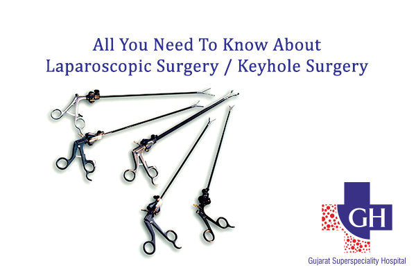 Laparoscopic-Surgery-Keyhole-Surgery-Gujarat-Kidney-and-Superspeciality-Hospital