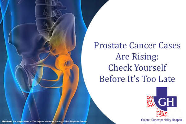 Prostate Cancer Cases Are Rising: Check Yourself Before It’s Too Late