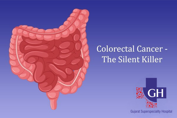 Colorectal-Cancer-The-Silent-Killer-Gujarat-Super-Speciality-Hospital-A