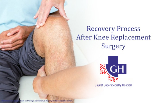 Recovery Process After Knee Replacement Surgery