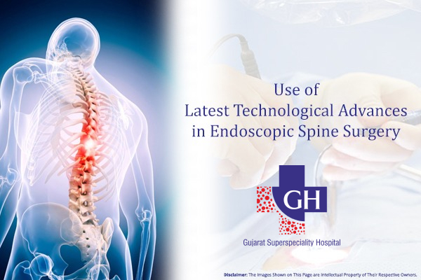 Use of Latest Technological Advances in Endoscopic Spine Surgery