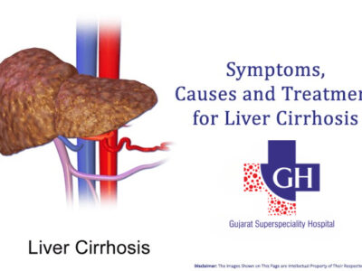 Symptoms, Causes and Treatment for Liver Cirrhosis