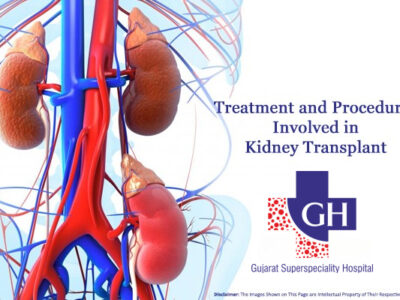 Treatment and Procedures Involved in Kidney Transplant