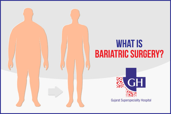 What is BaSriatric Surgery? | Bariatric Doctor Vadodara | Gujarat Superspeciality Hospital