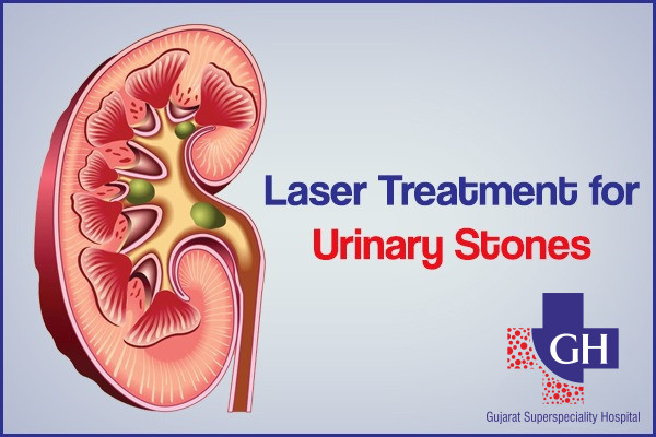 Laser-Treatment-for-Urinary-Stones-Gujarat-Kidney-and-Superspeciality-Hospital