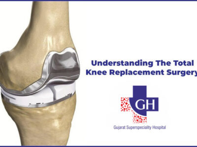 Understanding The Total Knee Replacement Surgery